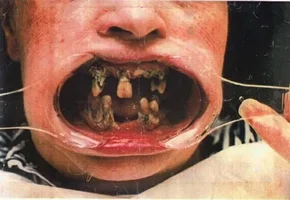 257727-uglyteeth.webp