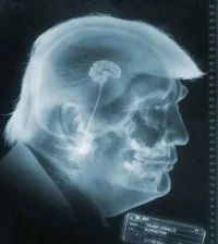 trump-brain-xray.webp